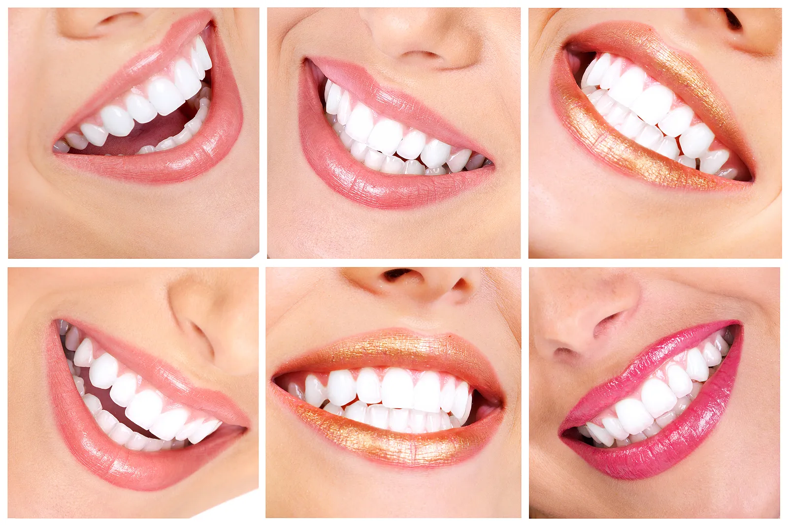 A Brighter Smile: Your Guide to Teeth Whitening in San Ramon, CA