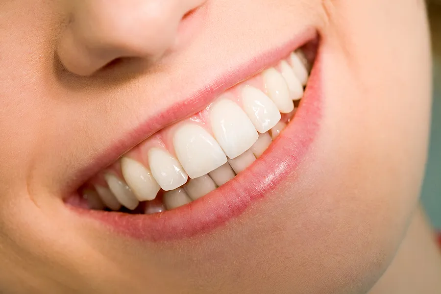 Transforming Your Smile: Complete Guide to a Smile Makeover in San Ramon, CA