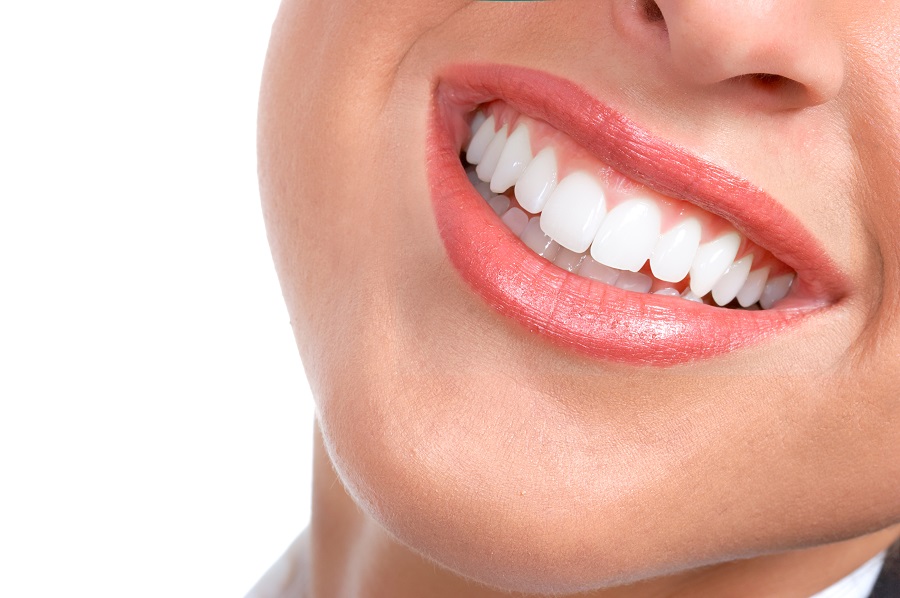CELEBRITY SMILES – BEFORE AND AFTER